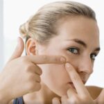 <strong>Best Essential Oils for Blackheads | Tips & How to Use</strong>